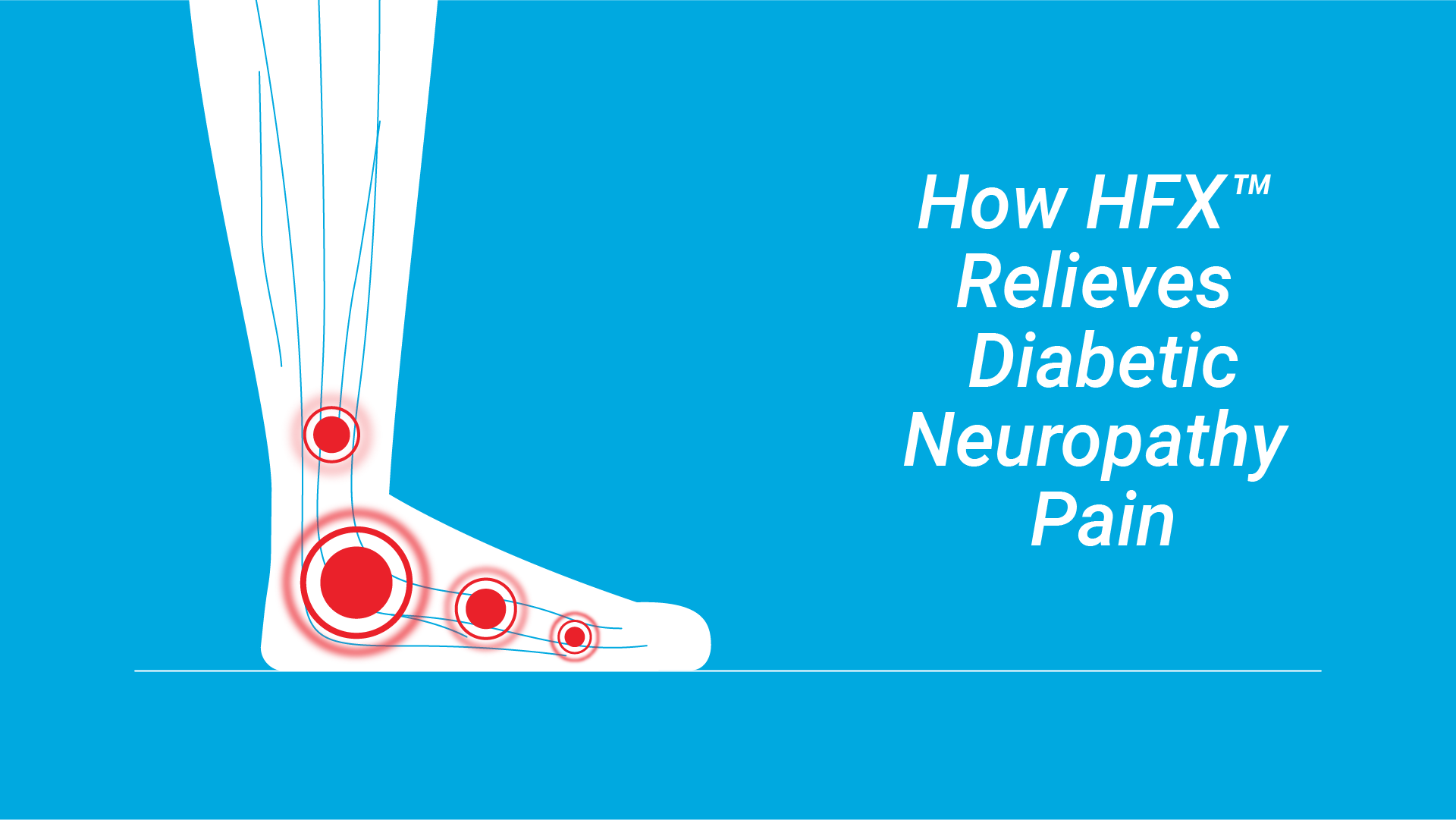 https://dev.hf10-pdn.staging.poundandgrain.ca/app/uploads/2025/07/Video-Thumbnail-HowHFXRelievesDiabeticNeuropathyPain.png